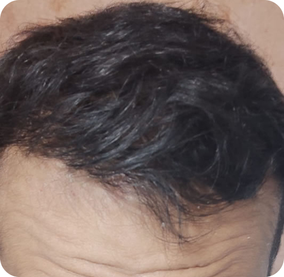 After