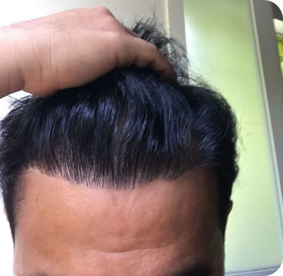 After