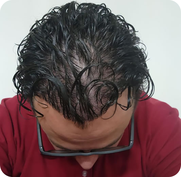 After